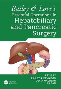 Bailey & Love's Essential Operations in Hepatobiliary and Pancreatic Surgery Bailey & Love's Essential Operations in Hepatobiliary and Pancreatic Surgery