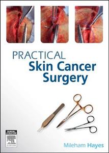 Practical Skin Cancer Surgery: From Fundamentals to Advanced Practical Skin Cancer Surgery: From Fundamentals to Advanced