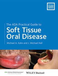 ADA Practical Guide to Soft Tissue Oral Disease, The