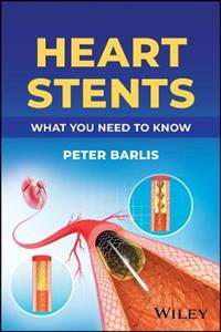 Heart Stents: What You Need to Know Heart Stents: What You Need to Know