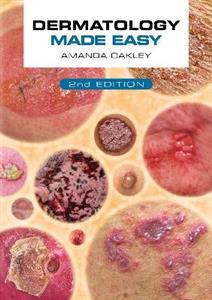Dermatology Made Easy, second edition Dermatology Made Easy, second edition
