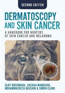 Dermatoscopy and Skin Cancer, second edition: A handbook for hunters of skin cancer and melanoma Dermatoscopy and Skin Cancer, second edition: A handbook for hunters of skin cancer and melanoma