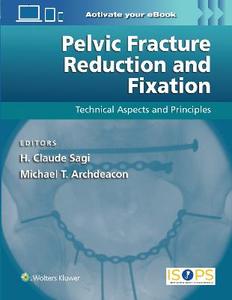 Pelvic Fracture Reduction and Fixation: Technical Aspects and Principles Pelvic Fracture Reduction and Fixation: Technical Aspects and Principles