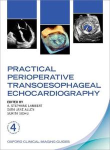Practical Perioperative Transoesophageal Echocardiography Ocig Paperback Practical Perioperative Transoesophageal Echocardiography Ocig Paperback