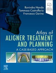 Atlas of Aligner Treatment and Planning: A Case-Based Approach Atlas of Aligner Treatment and Planning: A Case-Based Approach