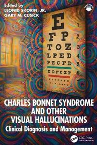 Charles Bonnet Syndrome and Other Visual Hallucinations: Clinical Diagnosis and Management Charles Bonnet Syndrome and Other Visual Hallucinations: Clinical Diagnosis and Management