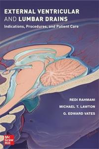 External Ventricular and Lumbar Drains: Indications, Procedures, and Patient Care External Ventricular and Lumbar Drains: Indications, Procedures, and Patient Care