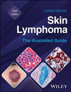 Skin Lymphoma: The Illustrated Guide Skin Lymphoma: The Illustrated Guide