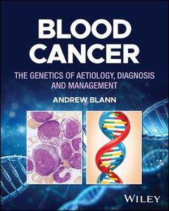 Blood Cancer: The Genetics of Aetiology, Diagnosis and Management Blood Cancer: The Genetics of Aetiology, Diagnosis and Management