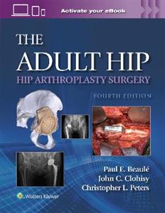 The Adult Hip: Hip Arthroplasty Surgery Print + eBook with Multimedia The Adult Hip: Hip Arthroplasty Surgery Print + eBook with Multimedia